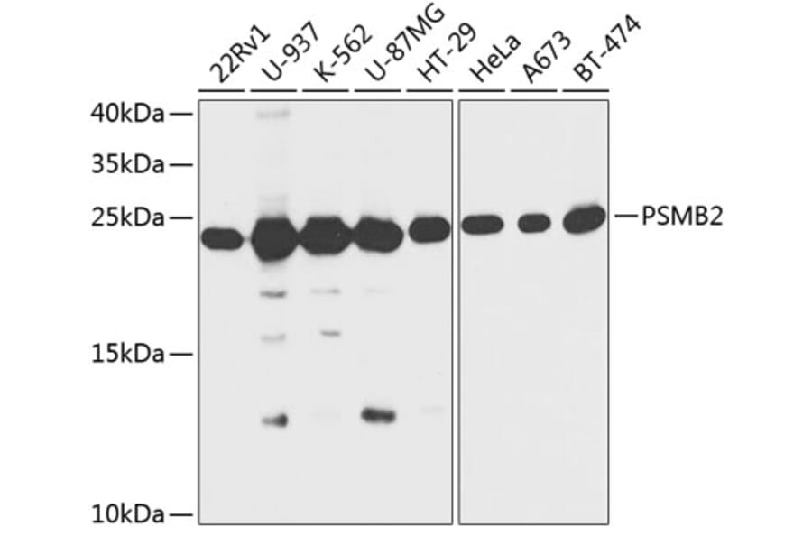 Western Blot - Anti-Proteasome subunit beta type 2/PSMB2 Antibody (A88820) - Antibodies.com