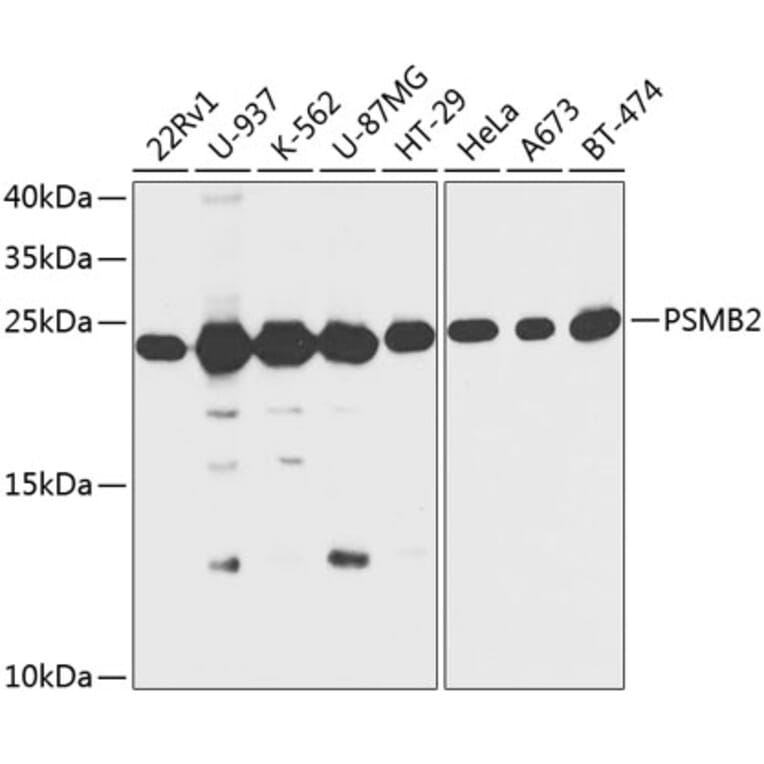 Western Blot - Anti-Proteasome subunit beta type 2/PSMB2 Antibody (A88820) - Antibodies.com