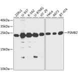 Western Blot - Anti-Proteasome subunit beta type 2/PSMB2 Antibody (A88820) - Antibodies.com