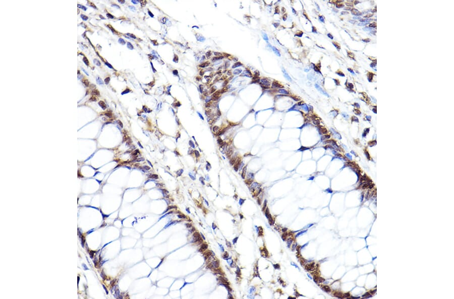 Immunohistochemistry - Anti-Proteasome subunit beta type 2/PSMB2 Antibody (A88820) - Antibodies.com
