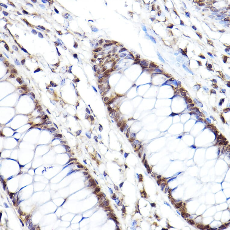 Immunohistochemistry - Anti-Proteasome subunit beta type 2/PSMB2 Antibody (A88820) - Antibodies.com