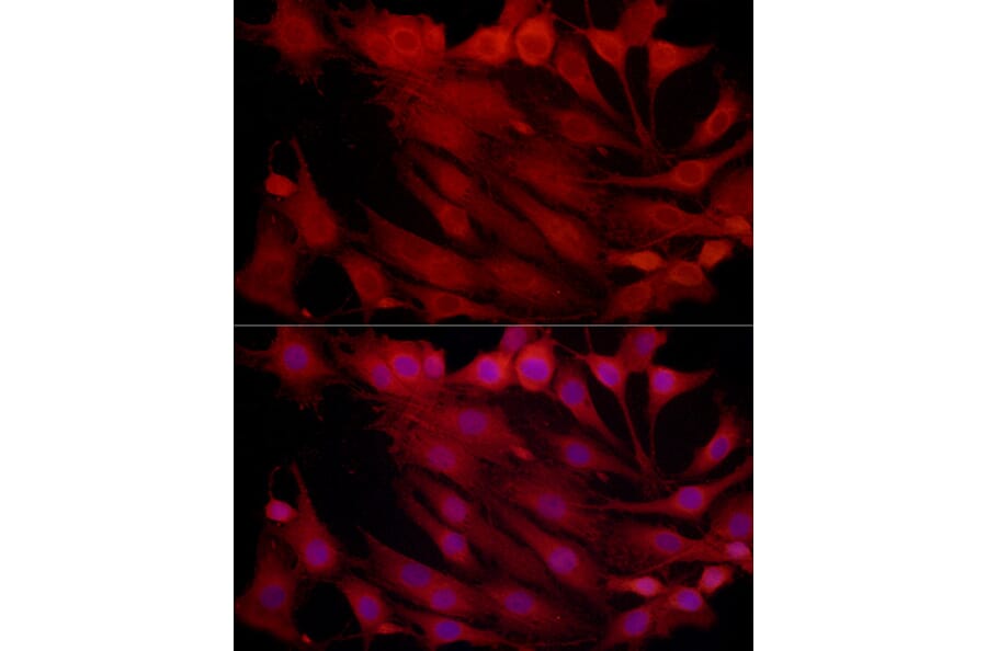 Immunofluorescence - Anti-Proteasome subunit beta type 2/PSMB2 Antibody (A88820) - Antibodies.com