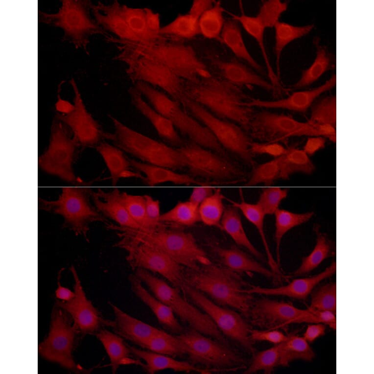 Immunofluorescence - Anti-Proteasome subunit beta type 2/PSMB2 Antibody (A88820) - Antibodies.com