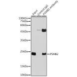 Western Blot - Anti-Proteasome subunit beta type 2/PSMB2 Antibody (A88820) - Antibodies.com