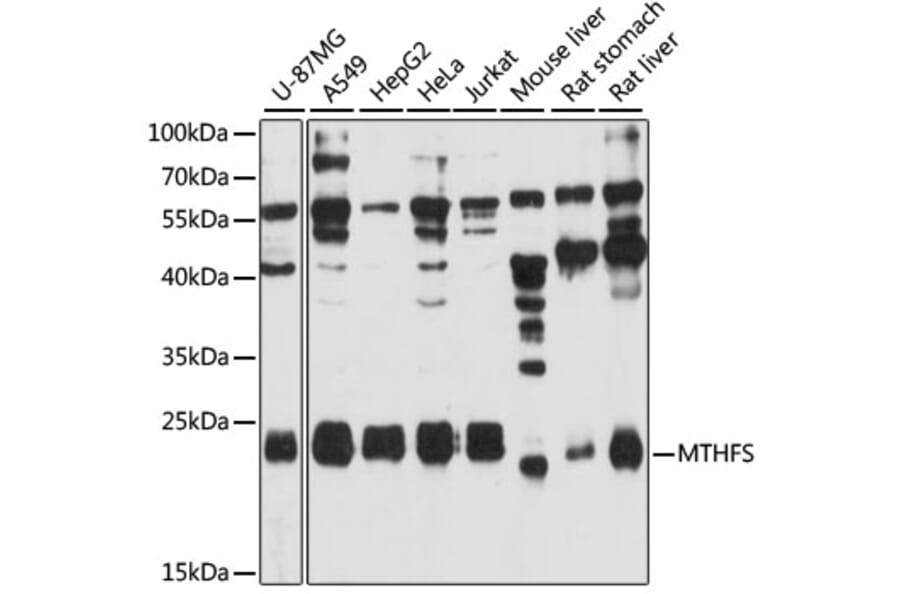 Western Blot - Anti-MTHFS Antibody (A12770) - Antibodies.com