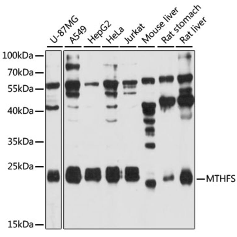 Western Blot - Anti-MTHFS Antibody (A12770) - Antibodies.com