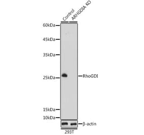 Western Blot - Anti-RhoGDI Antibody (A88822) - Antibodies.com