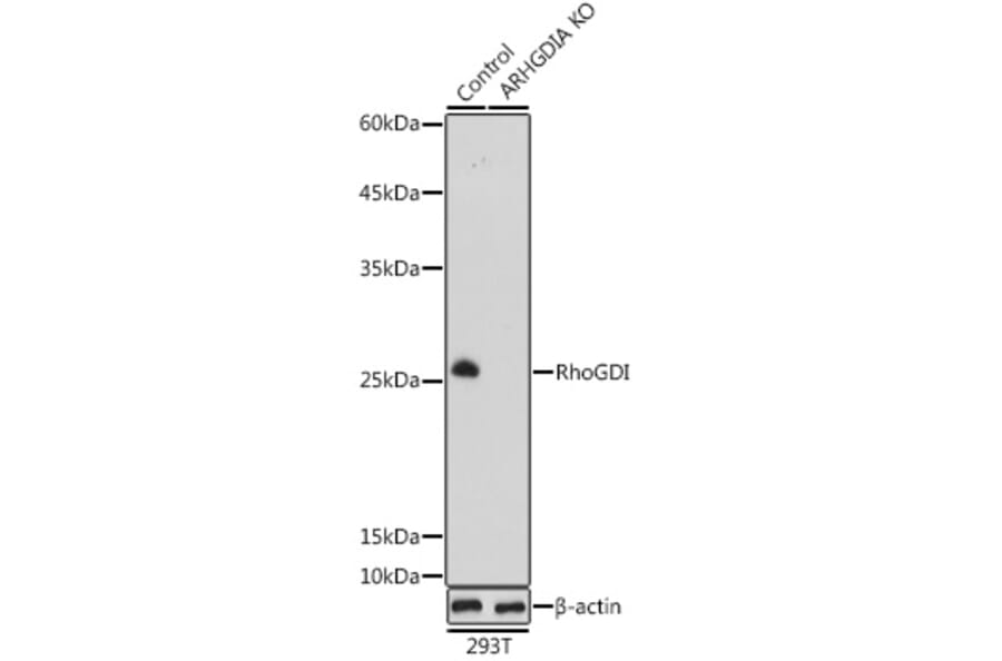 Western Blot - Anti-RhoGDI Antibody (A88822) - Antibodies.com