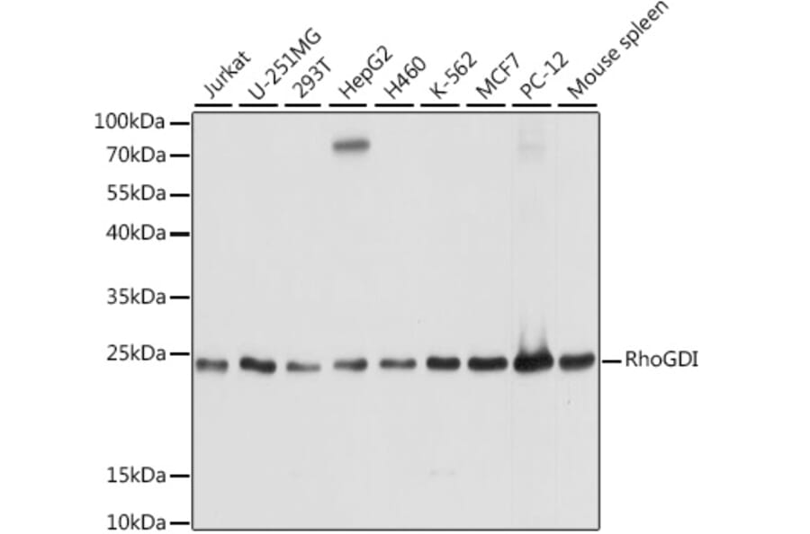 Western Blot - Anti-RhoGDI Antibody (A88822) - Antibodies.com