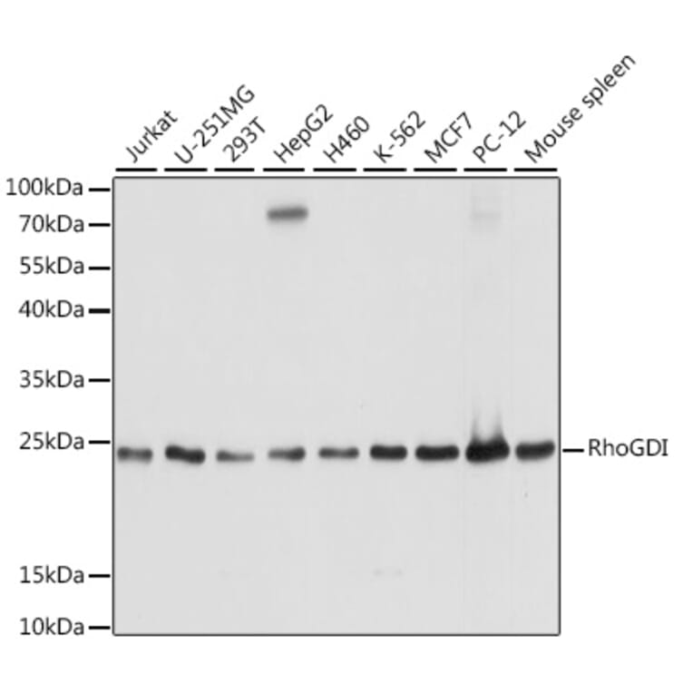Western Blot - Anti-RhoGDI Antibody (A88822) - Antibodies.com