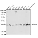 Western Blot - Anti-RhoGDI Antibody (A88822) - Antibodies.com