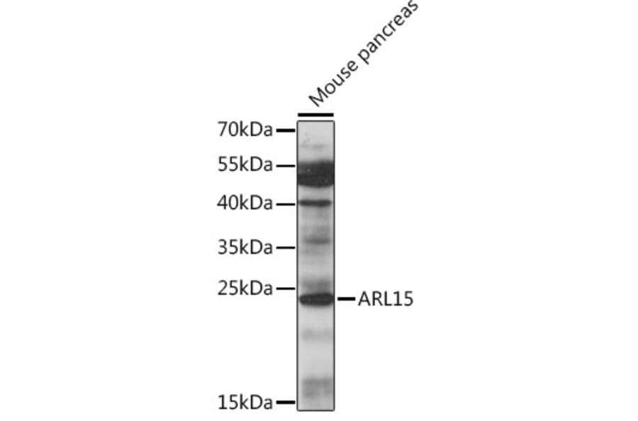 Western Blot - Anti-ARL15 Antibody (A88823) - Antibodies.com