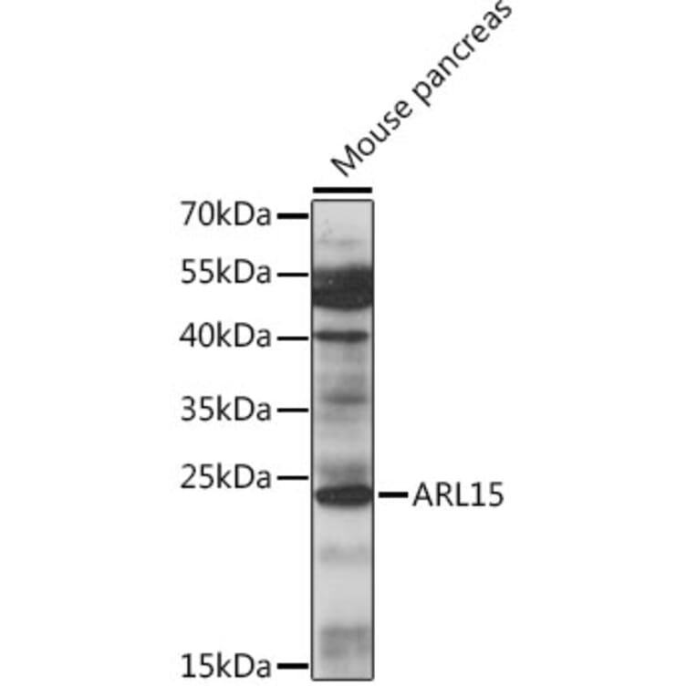 Western Blot - Anti-ARL15 Antibody (A88823) - Antibodies.com