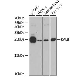 Western Blot - Anti-RALB Antibody (A88824) - Antibodies.com