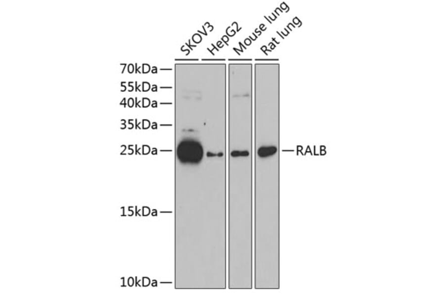 Western Blot - Anti-RALB Antibody (A88824) - Antibodies.com