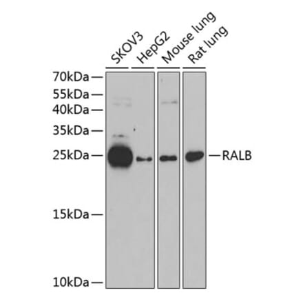 Western Blot - Anti-RALB Antibody (A88824) - Antibodies.com