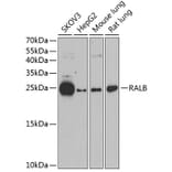 Western Blot - Anti-RALB Antibody (A88824) - Antibodies.com