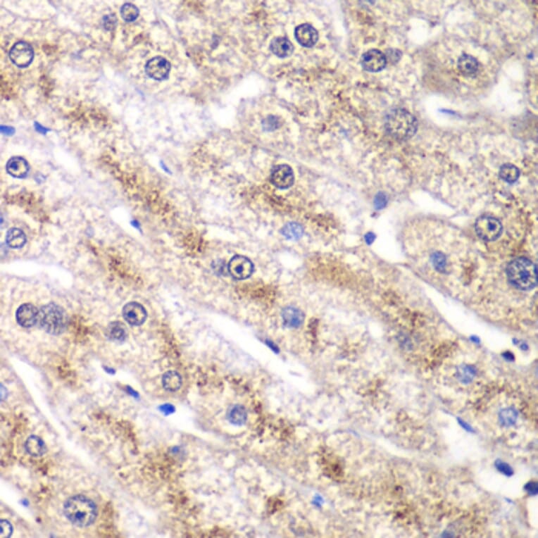 Immunohistochemistry - Anti-RALB Antibody (A88824) - Antibodies.com