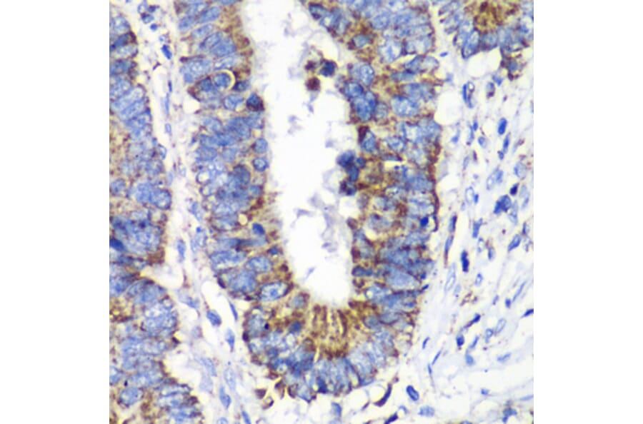 Immunohistochemistry - Anti-RALB Antibody (A88824) - Antibodies.com