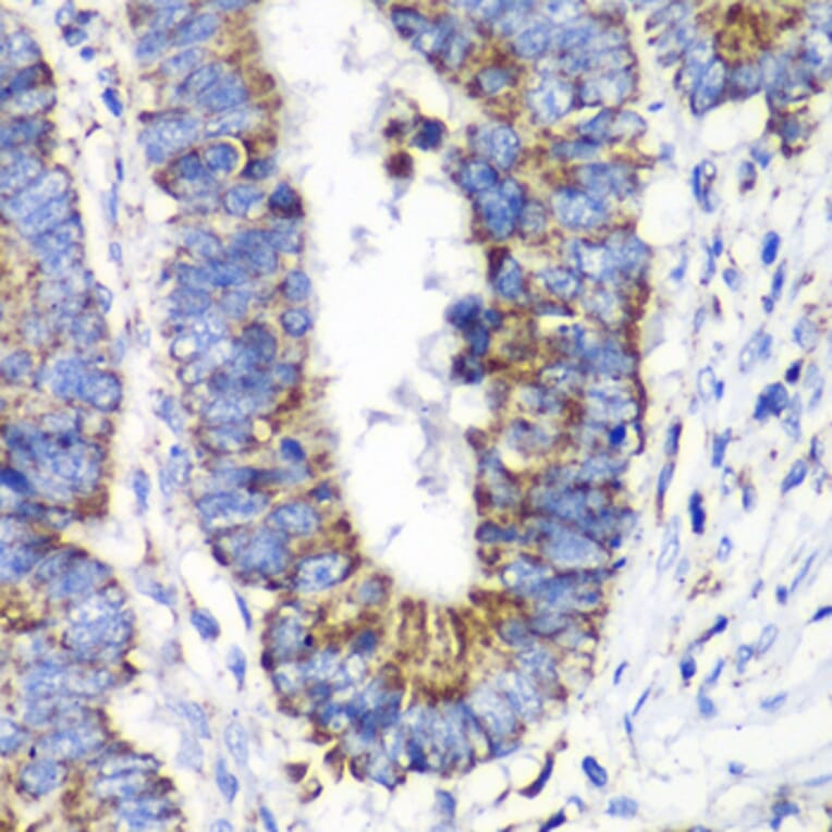 Immunohistochemistry - Anti-RALB Antibody (A88824) - Antibodies.com