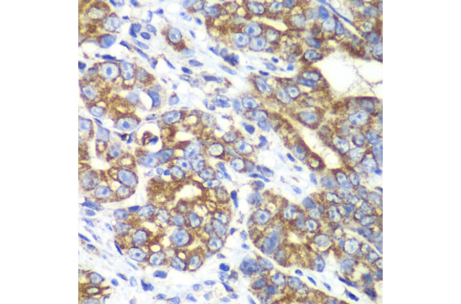 Immunohistochemistry - Anti-RALB Antibody (A88824) - Antibodies.com