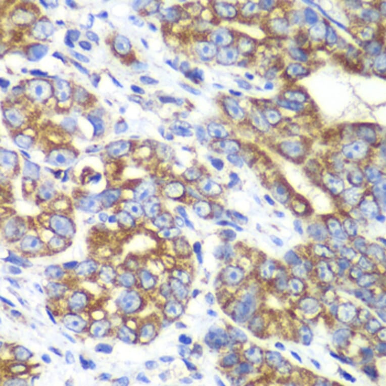 Immunohistochemistry - Anti-RALB Antibody (A88824) - Antibodies.com