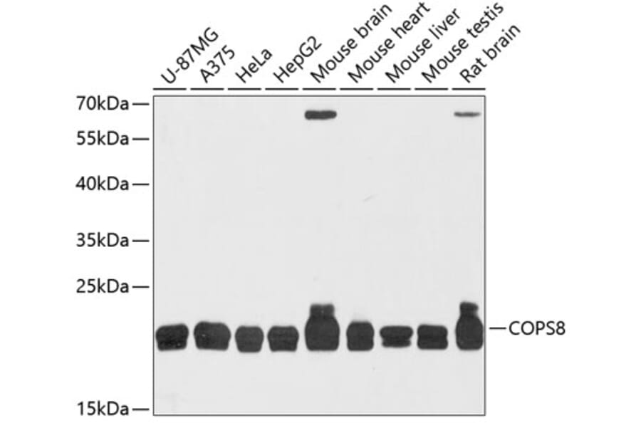 Western Blot - Anti-CSN8 Antibody (A88825) - Antibodies.com