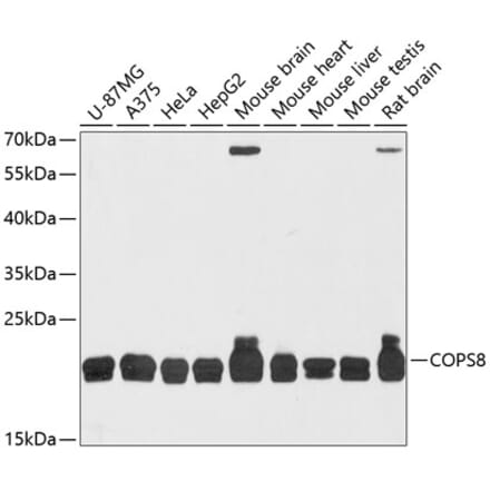 Western Blot - Anti-CSN8 Antibody (A88825) - Antibodies.com