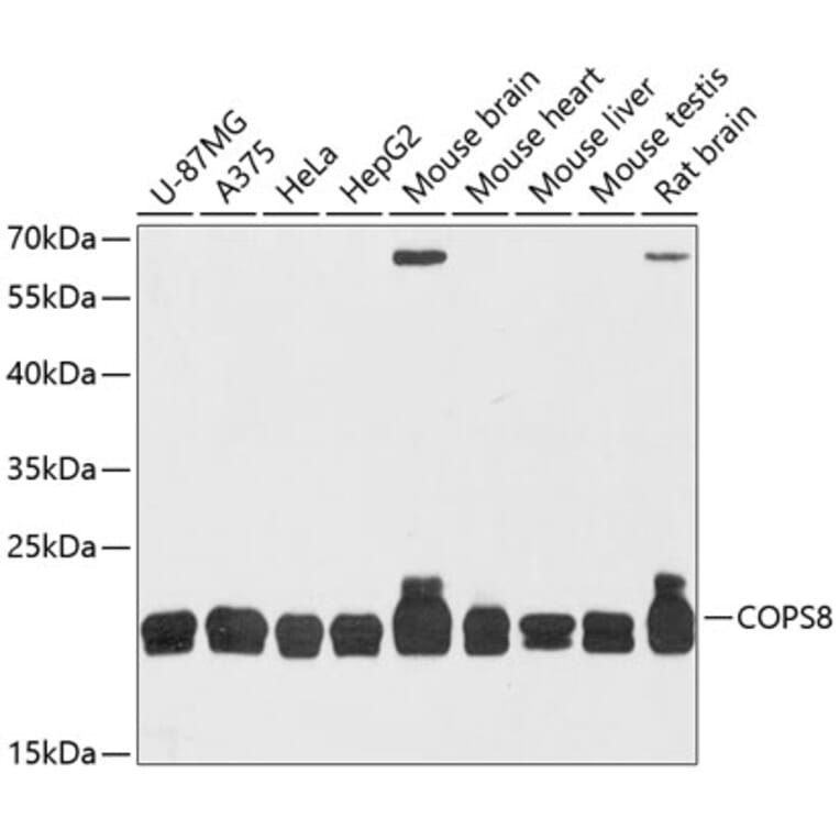 Western Blot - Anti-CSN8 Antibody (A88825) - Antibodies.com