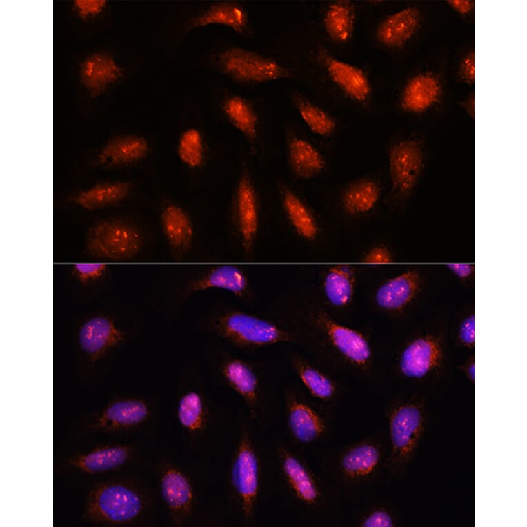 Immunofluorescence - Anti-CSN8 Antibody (A88825) - Antibodies.com