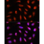 Immunofluorescence - Anti-CSN8 Antibody (A88825) - Antibodies.com