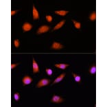 Immunofluorescence - Anti-CSN8 Antibody (A88825) - Antibodies.com