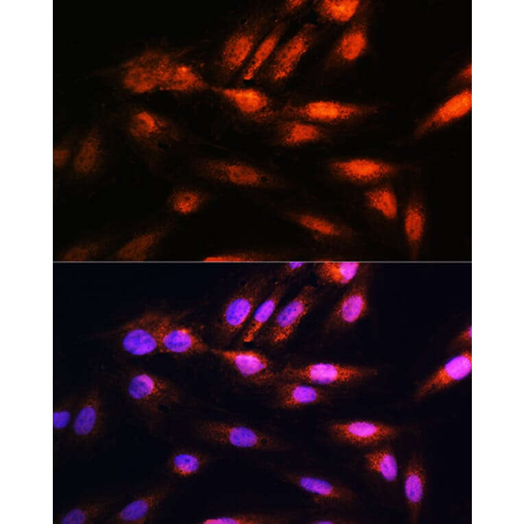 Immunofluorescence - Anti-CSN8 Antibody (A88825) - Antibodies.com