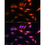 Immunofluorescence - Anti-CSN8 Antibody (A88825) - Antibodies.com