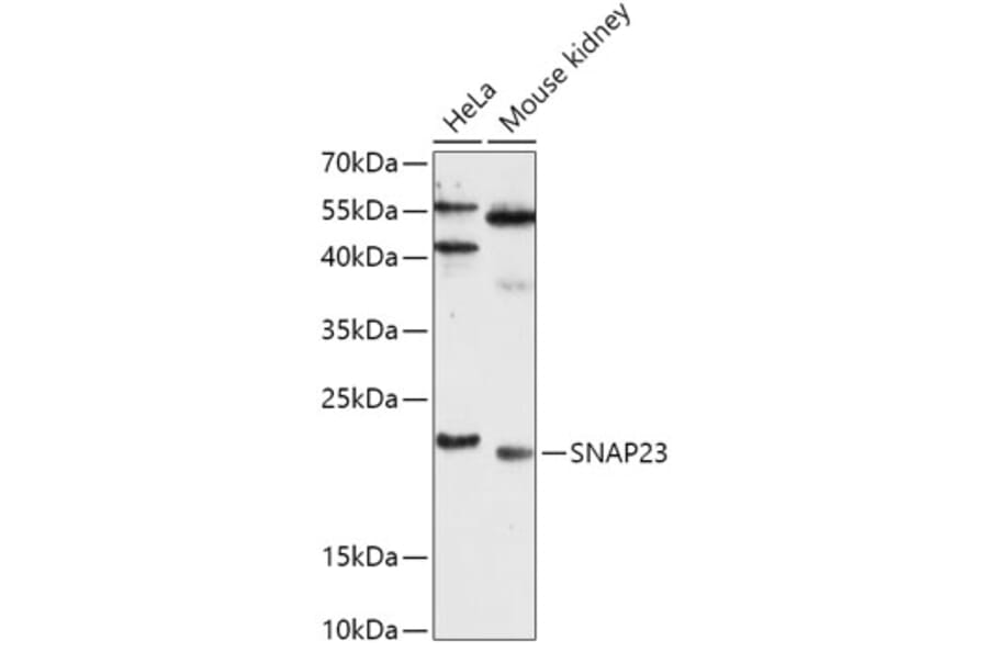 Western Blot - Anti-SNAP23 Antibody (A88826) - Antibodies.com