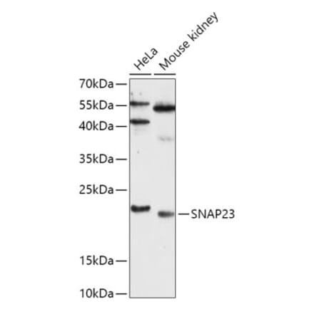 Western Blot - Anti-SNAP23 Antibody (A88826) - Antibodies.com