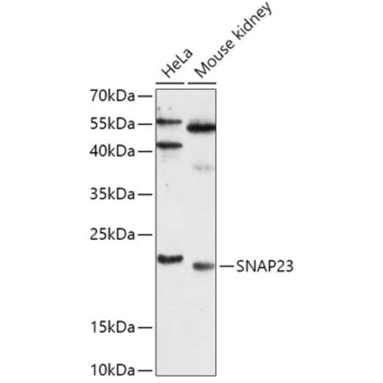 Western Blot - Anti-SNAP23 Antibody (A88826) - Antibodies.com