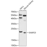 Western Blot - Anti-SNAP23 Antibody (A88826) - Antibodies.com