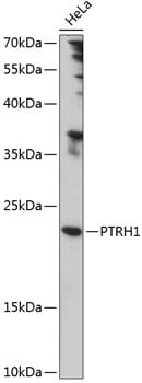 Western blot analysis of extracts of HeLa cells, using Anti-PTRH1 Antibody (A14448) at 1:1,000 dilution.
Secondary antibody: Goat Anti-Rabbit IgG (H+L) (HRP) (AS014) at 1:10,000 dilution.
Lysates / proteins: 25µg per lane.
Blocking buffer: 3% non-fat dry milk in TBST.
Detection: ECL Enhanced Kit (RM00021).
Exposure time: 90s.