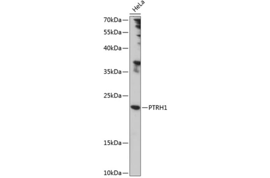 Western Blot - Anti-PTRH1 Antibody (A88827) - Antibodies.com