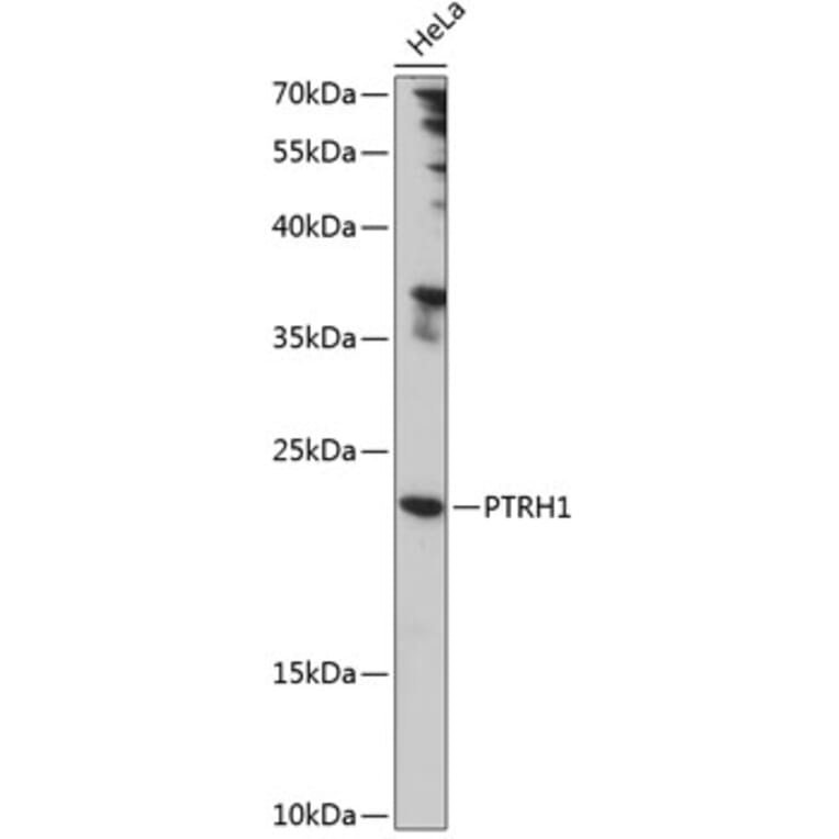 Western Blot - Anti-PTRH1 Antibody (A88827) - Antibodies.com