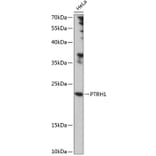 Western Blot - Anti-PTRH1 Antibody (A88827) - Antibodies.com
