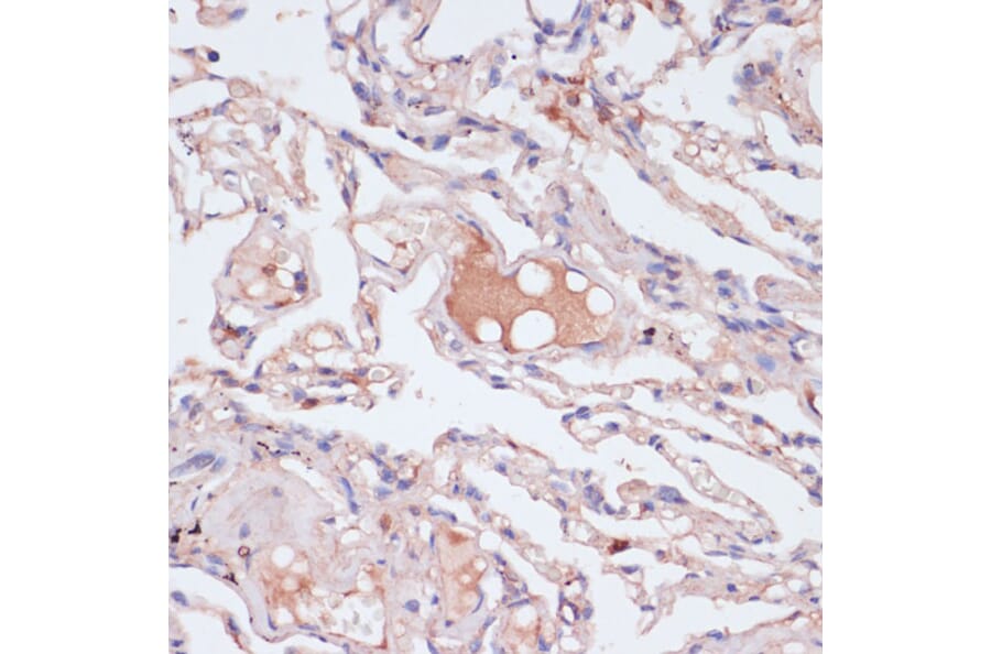 Immunohistochemistry - Anti-Interferon gamma Antibody (A88828) - Antibodies.com