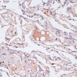 Immunohistochemistry - Anti-Interferon gamma Antibody (A88828) - Antibodies.com