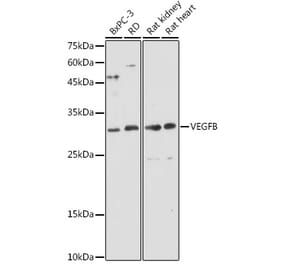 Western Blot - Anti-VEGFB Antibody (A88829) - Antibodies.com