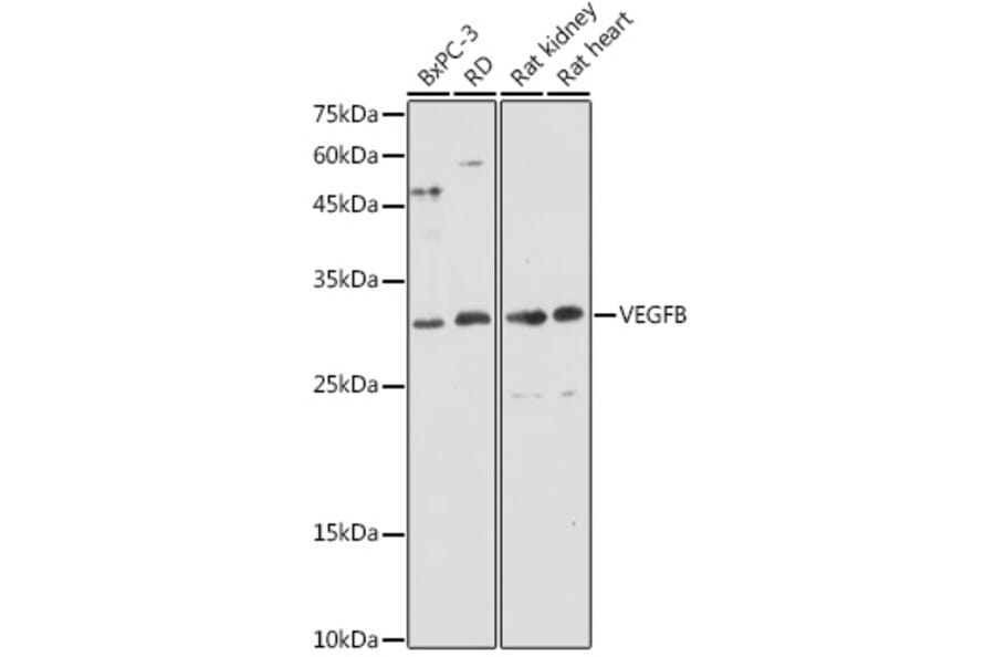 Western Blot - Anti-VEGFB Antibody (A88829) - Antibodies.com