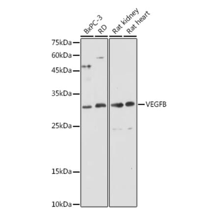 Western Blot - Anti-VEGFB Antibody (A88829) - Antibodies.com