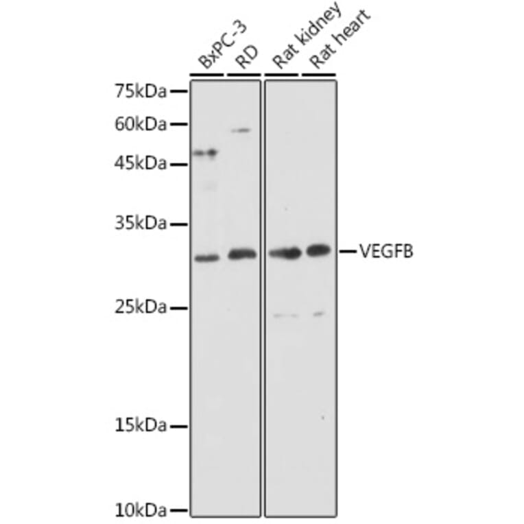 Western Blot - Anti-VEGFB Antibody (A88829) - Antibodies.com