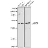 Western Blot - Anti-VEGFB Antibody (A88829) - Antibodies.com