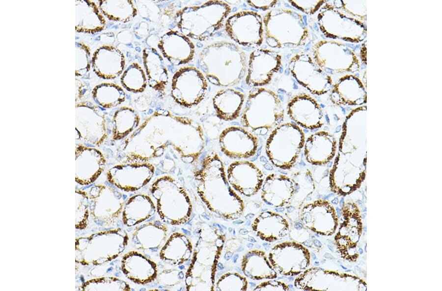 Immunohistochemistry - Anti-VEGFB Antibody (A88829) - Antibodies.com
